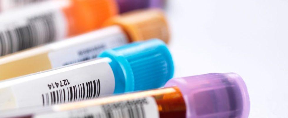 bloodtests bloodtests